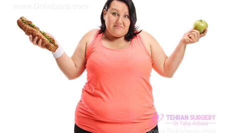 What you should do before the weight loss surgery?