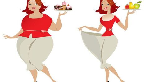 Bariatric surgery