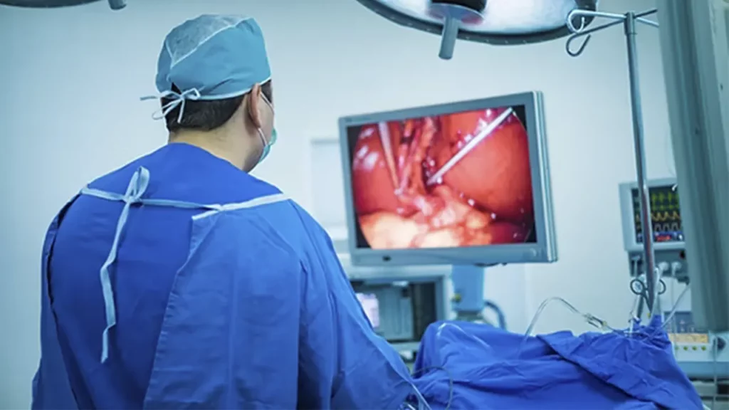 A bariatric surgeon performing a laparoscopic procedure.