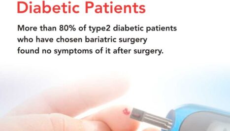bariatric surgery for type 2 diabetes