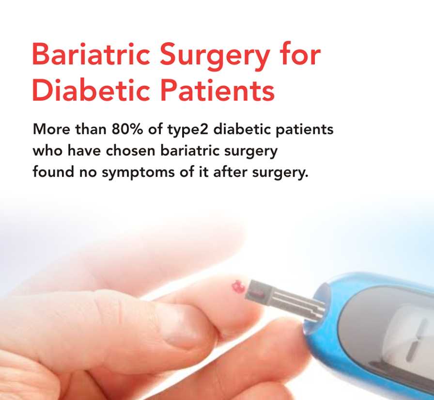 bariatric surgery for type 2 diabetes