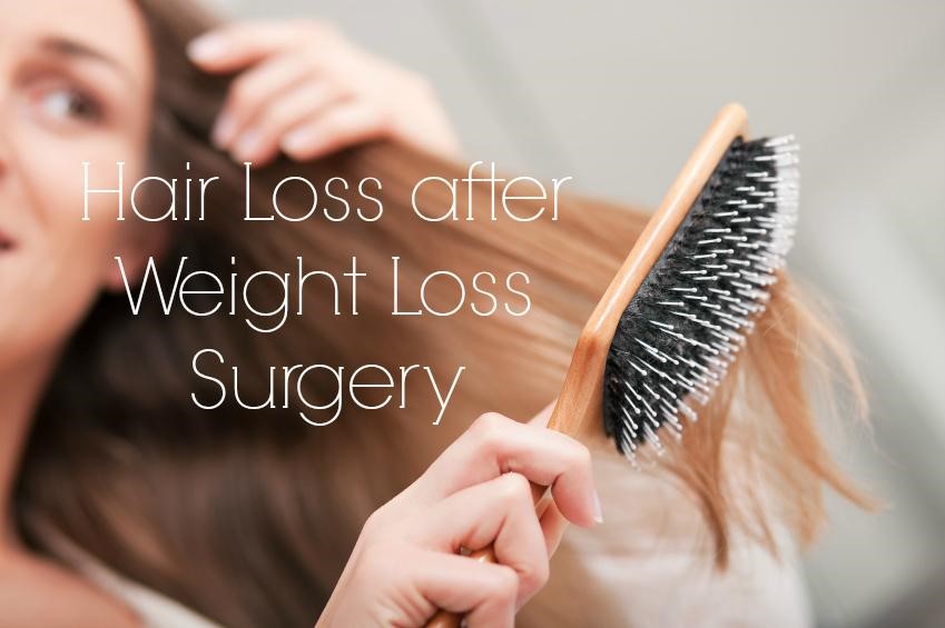 hair loss following weight loss surgery