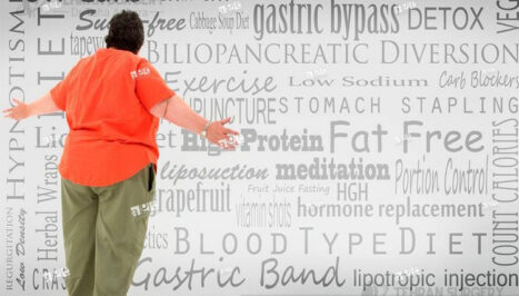 requirements for bariatric surgery