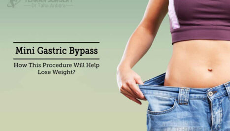 Mini bypass