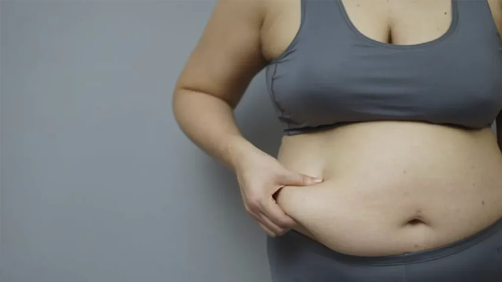 Fat woman showing her belly fat