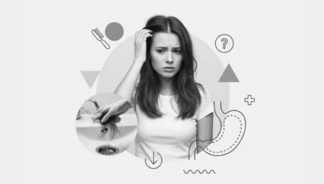Hair loss after weight loss surgery