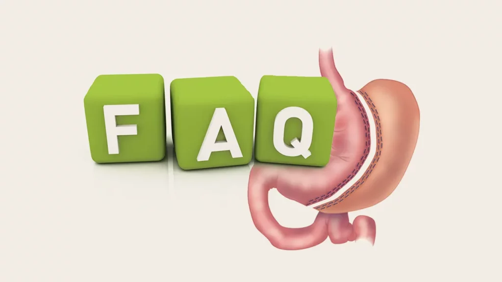 Common Questions and Answers About Gastric Sleeve