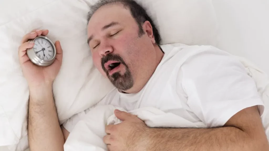 A person who has sleep apnea due to obesity